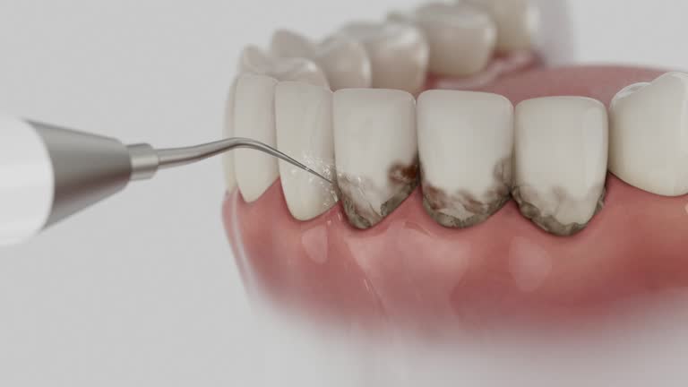 Trusted Dental Implants service in Groveport, OH - Dentist Open Now